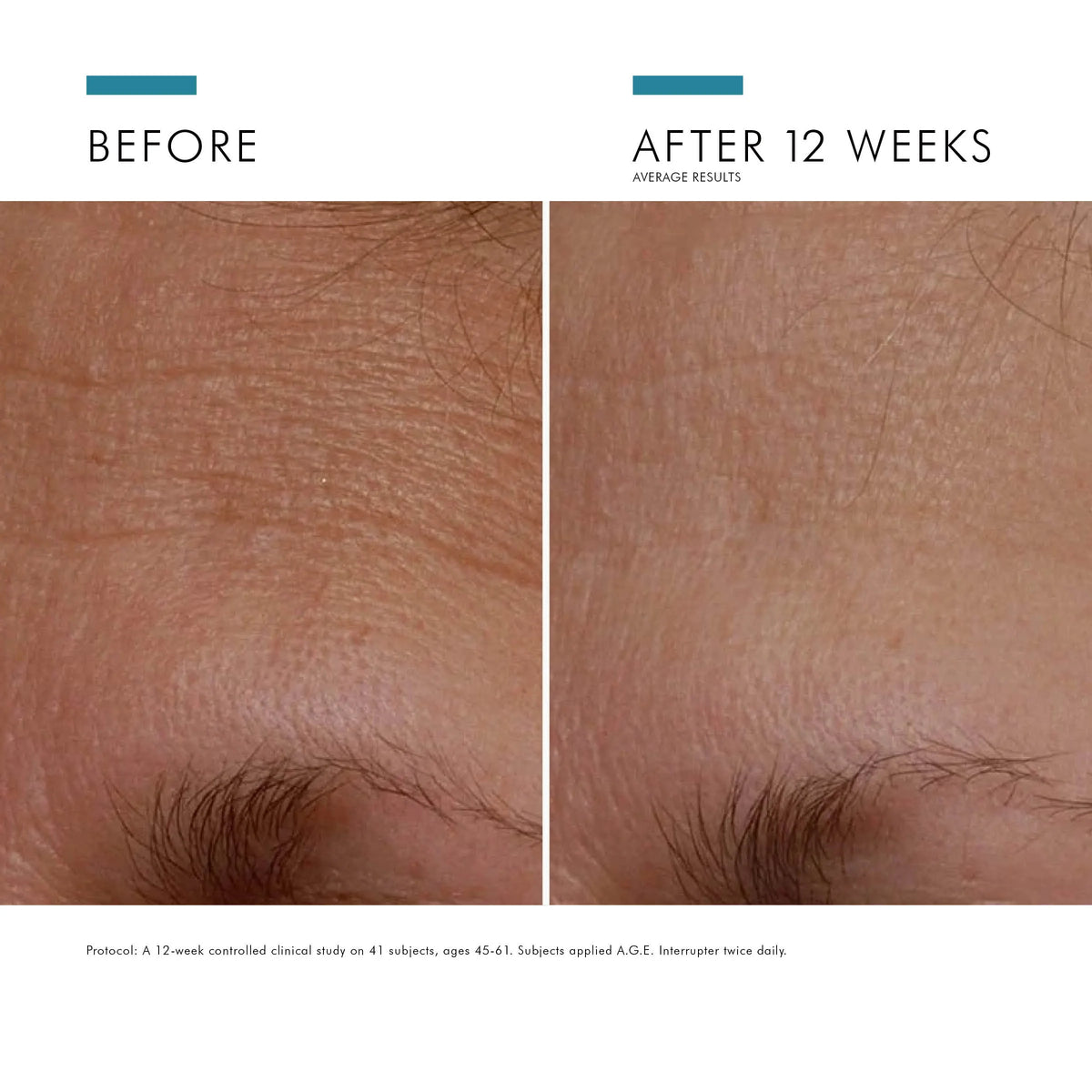 A.G.E. Interrupter Advanced (15ml) from SkinCeuticals Availble To Purchase Online from The Remedy Lounge in Cornwall, ON