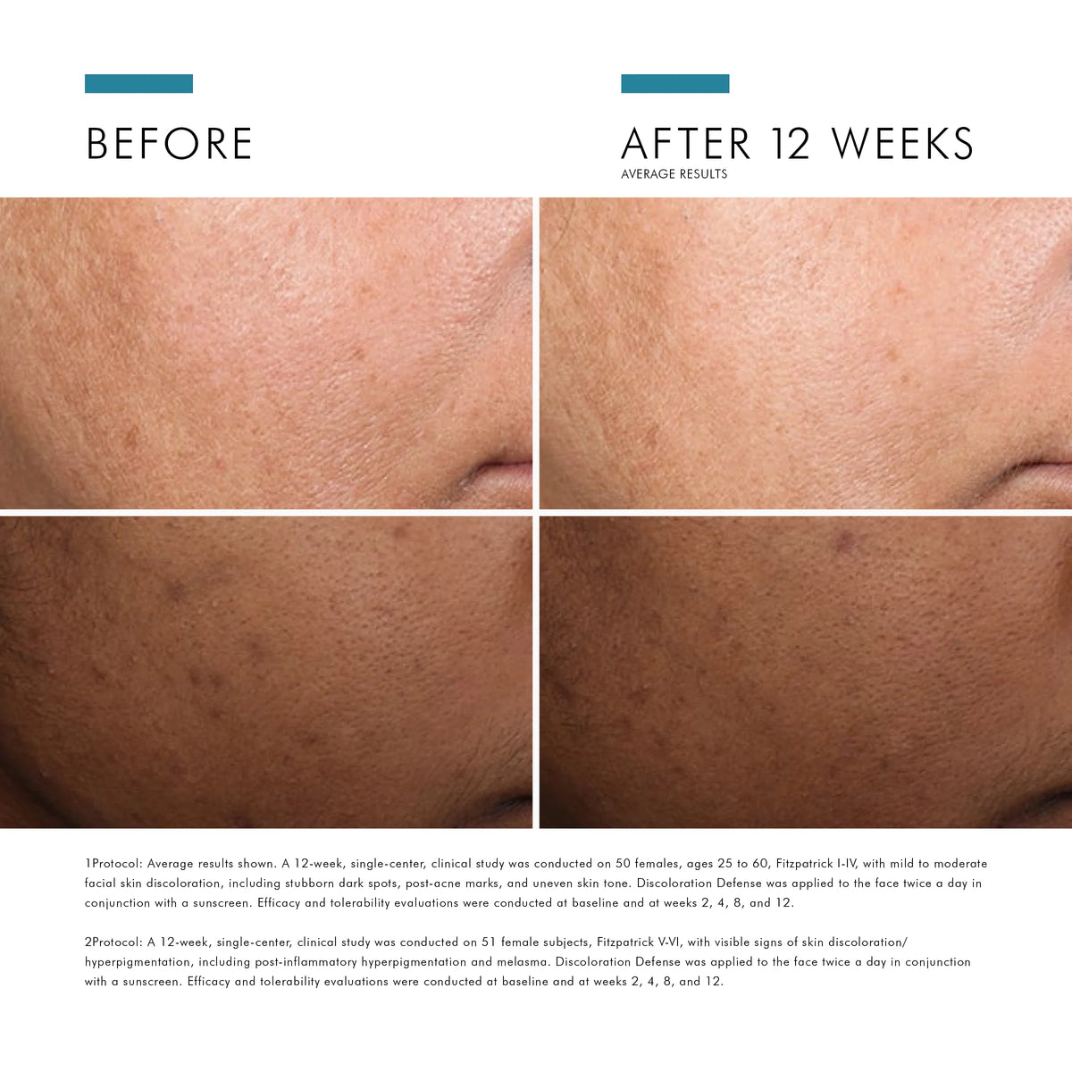 Discoloration Defense from SkinCeuticals Availble To Purchase Online from The Remedy Lounge in Cornwall, ON