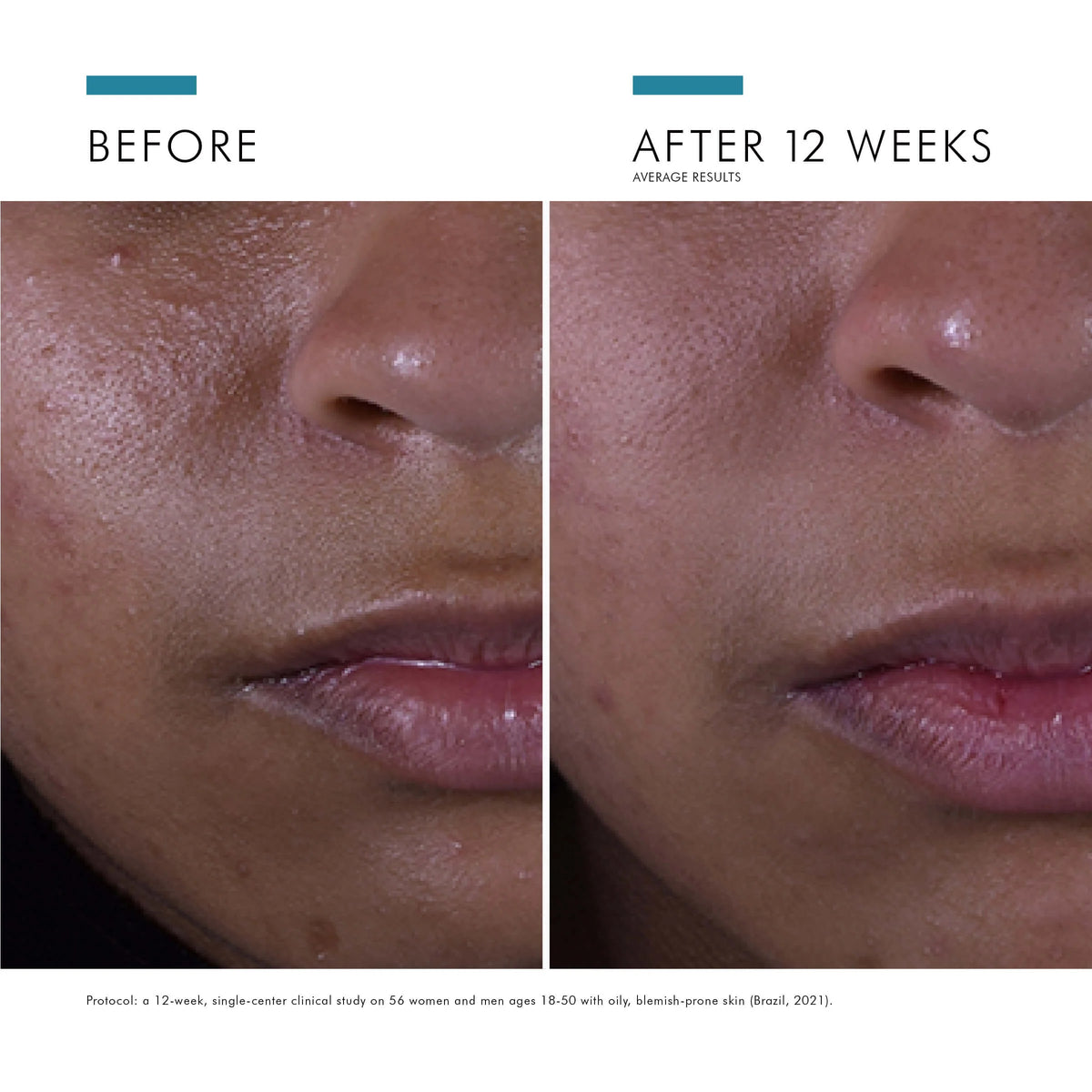 Silymarin CF from SkinCeuticals Availble To Purchase Online from The Remedy Lounge in Cornwall, ON
