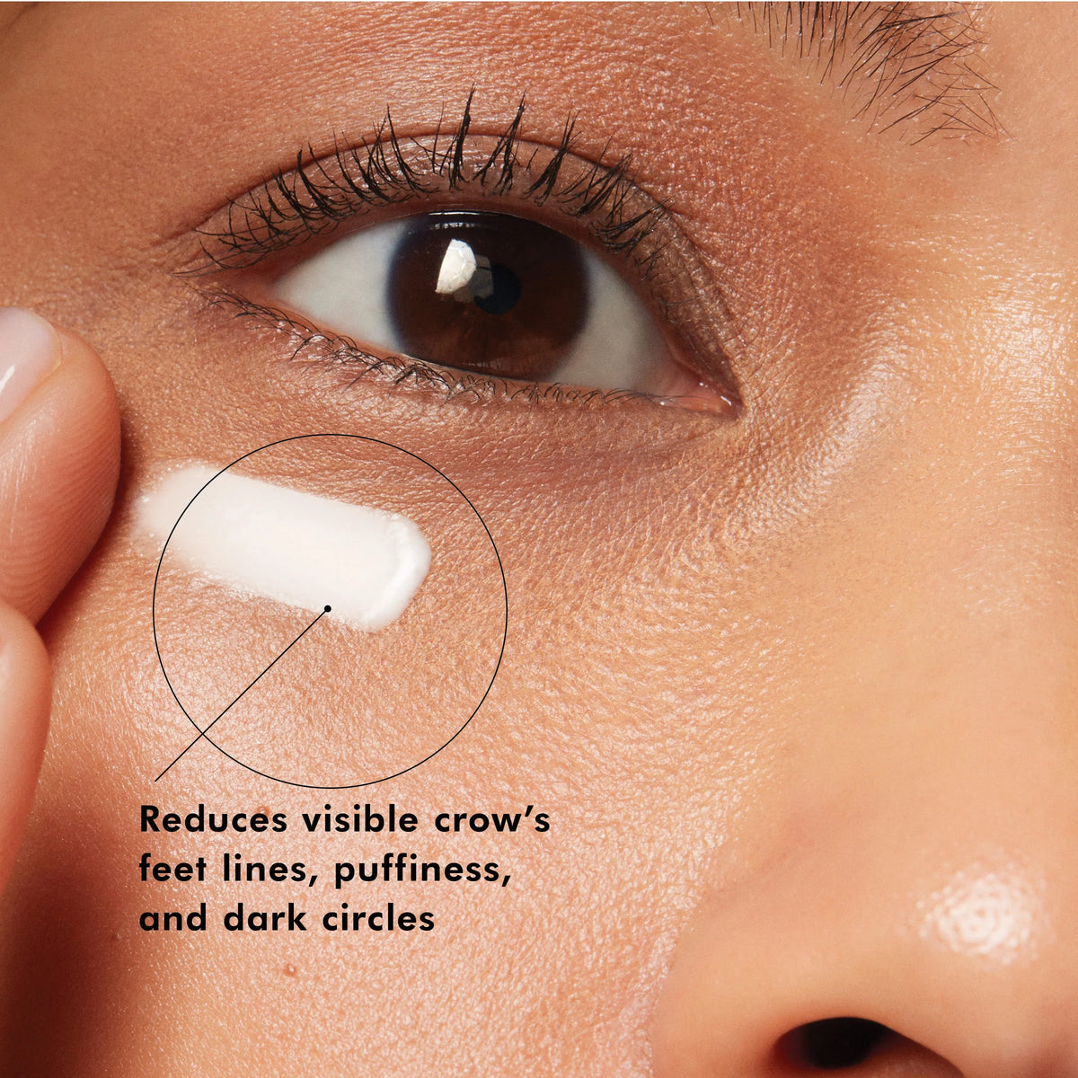 A.G.E. Advanced Eye from SkinCeuticals Availble To Purchase Online from The Remedy Lounge in Cornwall, ON