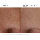 A.G.E. Interrupter Advanced (15ml) from SkinCeuticals Availble To Purchase Online from The Remedy Lounge in Cornwall, ON