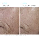 C E Ferulic with 15% L-Ascorbic Acid from SkinCeuticals Availble To Purchase Online from The Remedy Lounge in Cornwall, ON