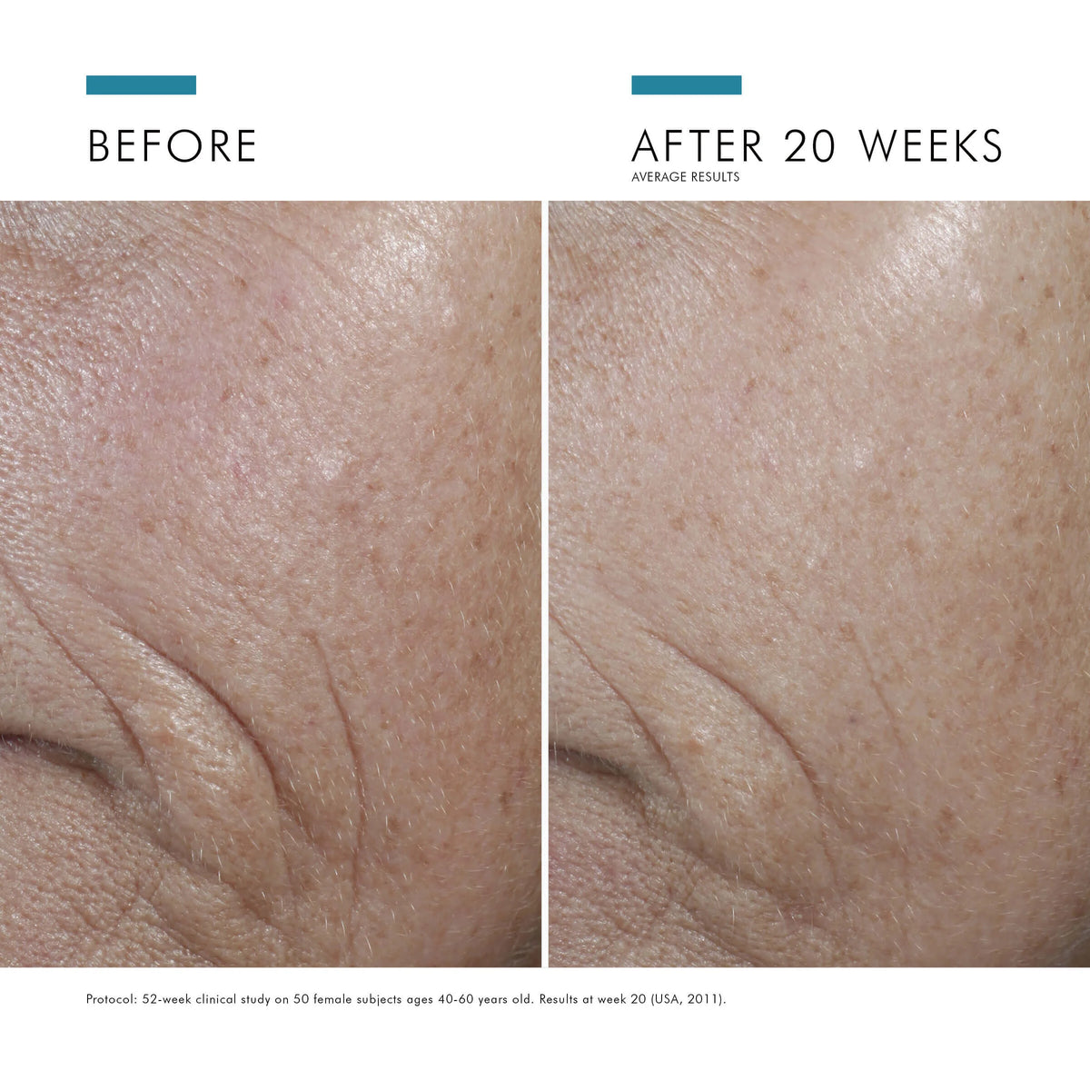 C E Ferulic with 15% L-Ascorbic Acid from SkinCeuticals Availble To Purchase Online from The Remedy Lounge in Cornwall, ON