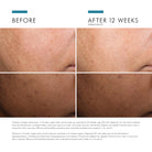 Discoloration Defense from SkinCeuticals Availble To Purchase Online from The Remedy Lounge in Cornwall, ON