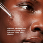 LHA Serum from SkinCeuticals Availble To Purchase Online from The Remedy Lounge in Cornwall, ON