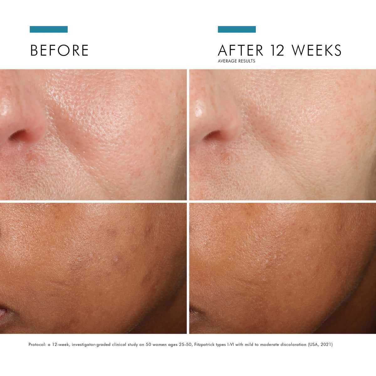 Phloretin CF with Ferulic Acid 15ml from SkinCeuticals Availble To Purchase Online from The Remedy Lounge in Cornwall, ON