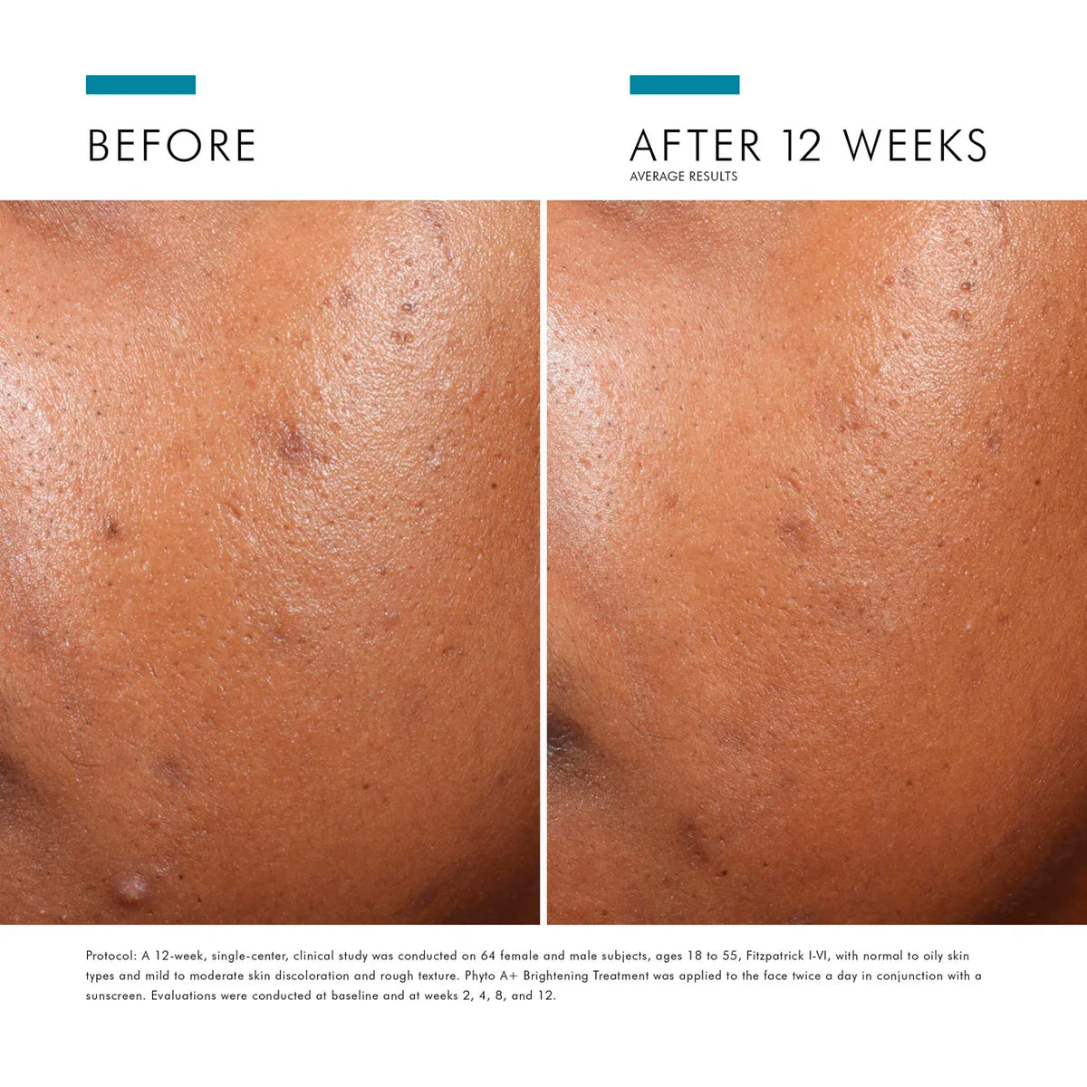 Phyto A+ Brightening Treatment from SkinCeuticals Availble To Purchase Online from The Remedy Lounge in Cornwall, ON