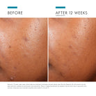 Phyto A+ Brightening Treatment from SkinCeuticals Availble To Purchase Online from The Remedy Lounge in Cornwall, ON