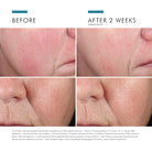 Phyto Corrective Essence Mist from SkinCeuticals Availble To Purchase Online from The Remedy Lounge in Cornwall, ON