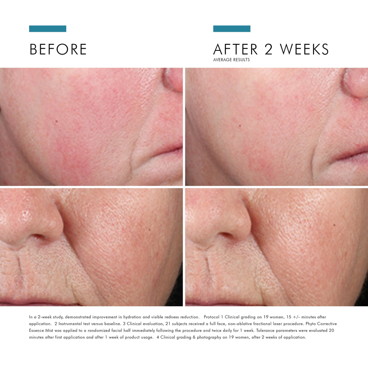 Phyto Corrective Essence Mist from SkinCeuticals Availble To Purchase Online from The Remedy Lounge in Cornwall, ON