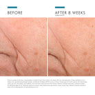 Triple Lipid Restore 2:4:2 from SkinCeuticals Availble To Purchase Online from The Remedy Lounge in Cornwall, ON
